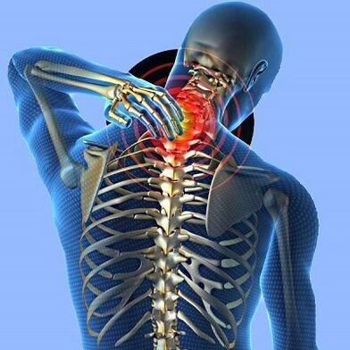 bol u vratu s cervikalnom osteohondrozom